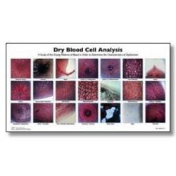 Dried Blood Cell Analysis Chart